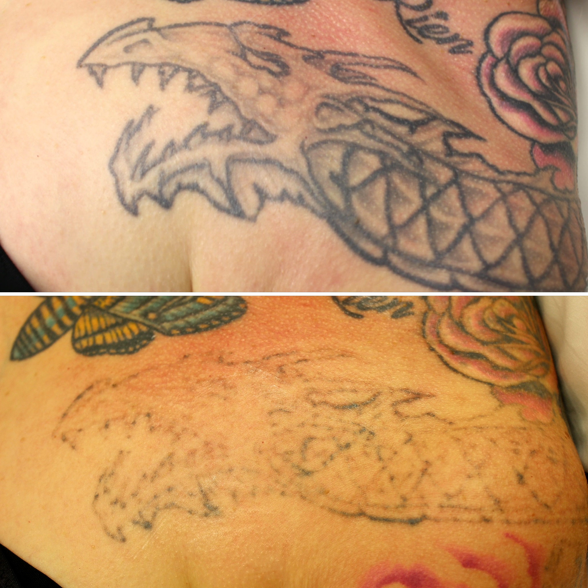 en tatuering som haleknats